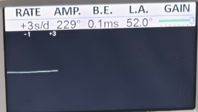 P18 · timing display